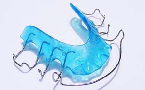 ارتودنسی متحرک