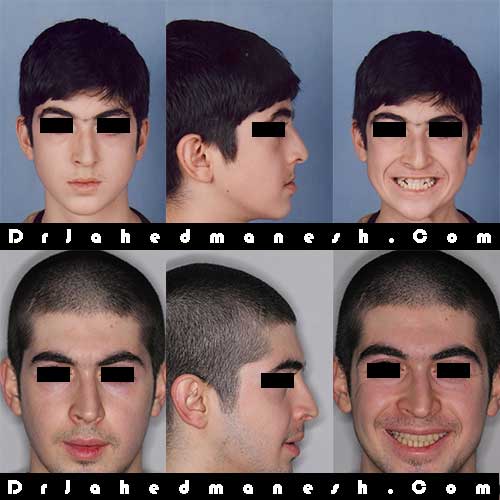 محدوده سن درمان ارتودنسی