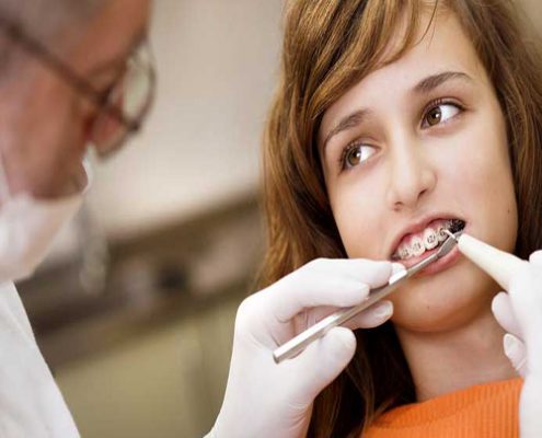 نحوه عملکرد دستگاه ارتودنسی